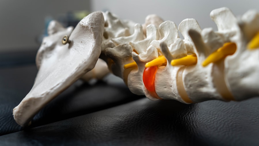 Photo spine injury lawyer